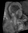 Fetal reslice